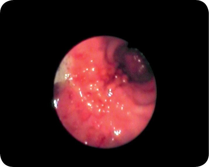 WWP_3_10_Marcin_Jankowski_PRZEROSTOWE_ZWEZENIE_ODZWIERNIKA_U_PSA_RYC_1