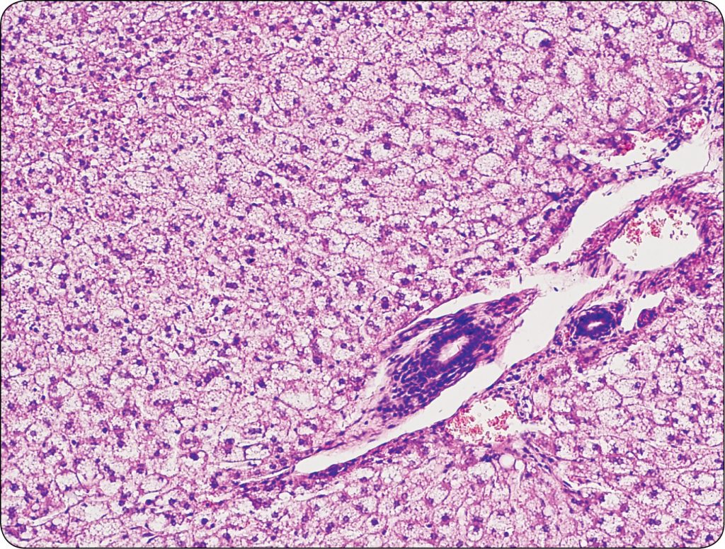 Stłuszczenie wątroby kotów