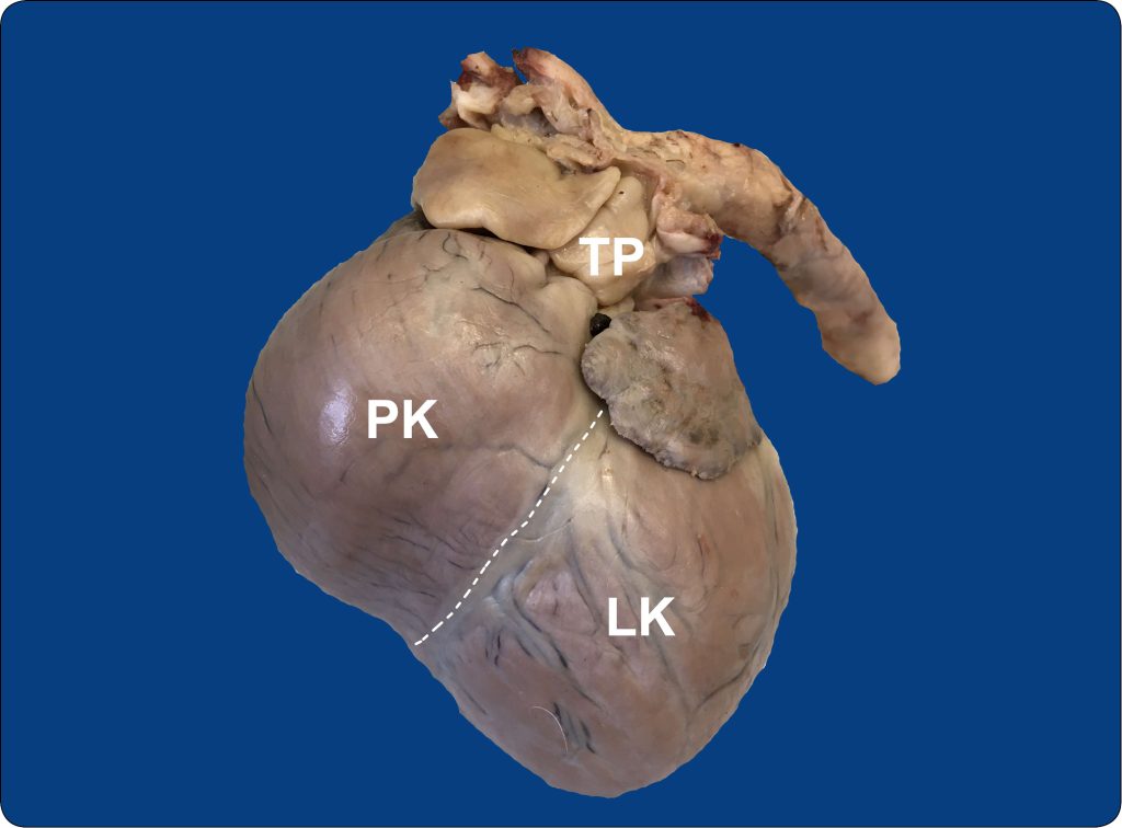 WWP_3_24_Izabela_Janus_ZMIANY_W_PRAWEJ_CZESCI_SERCA_RYC_2_A