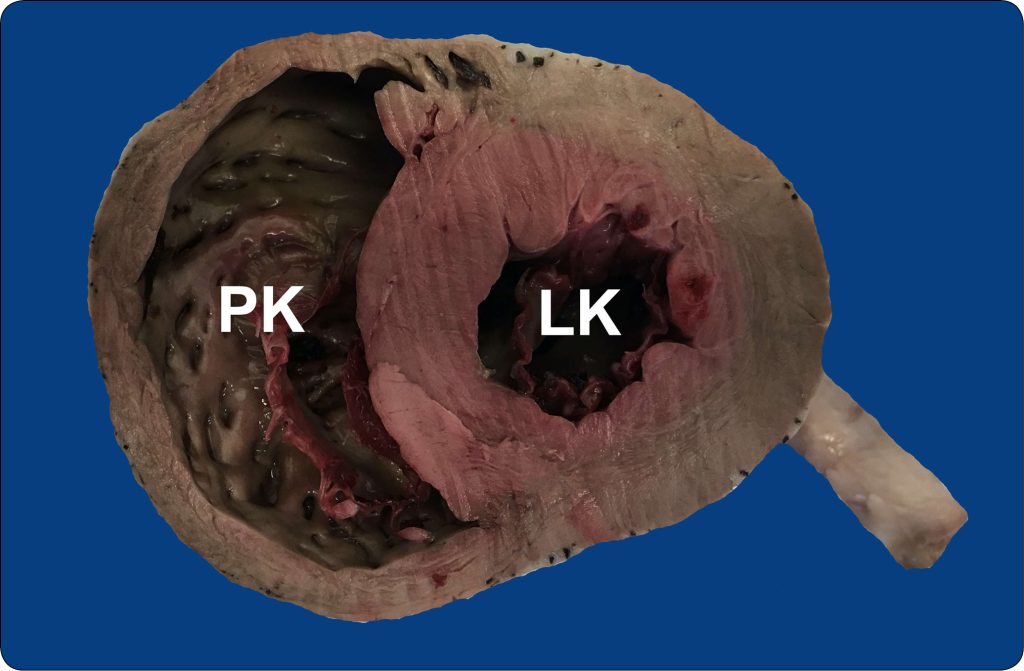 WWP_3_24_Izabela_Janus_ZMIANY_W_PRAWEJ_CZESCI_SERCA_RYC_2_B