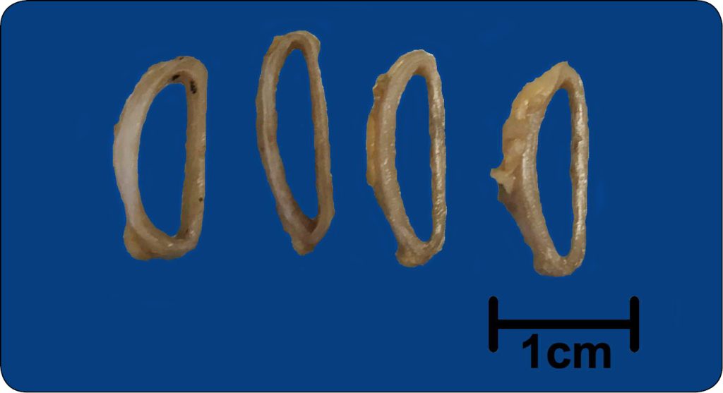 WWP_3_24_Izabela_Janus_ZMIANY_W_PRAWEJ_CZESCI_SERCA_RYC_3 serca