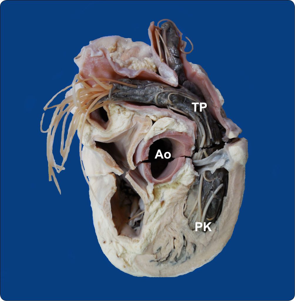 WWP_3_24_Izabela_Janus_ZMIANY_W_PRAWEJ_CZESCI_SERCA_RYC_5 serca