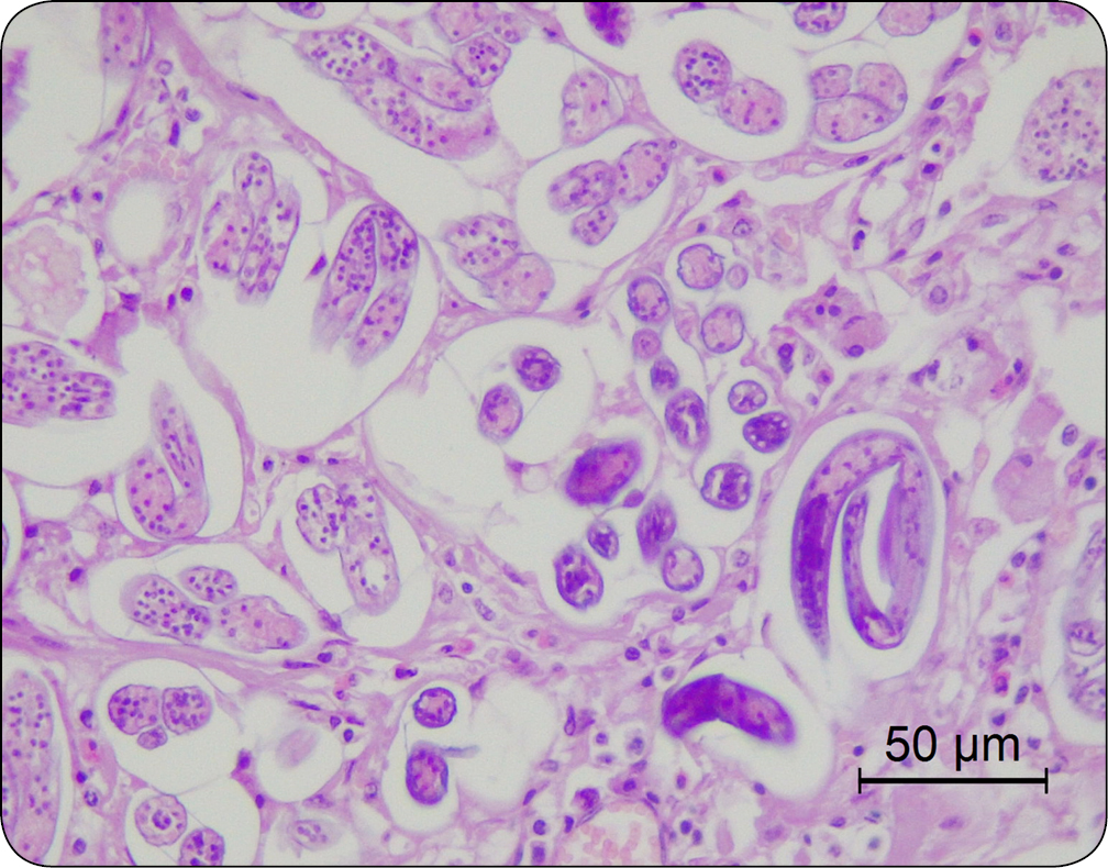 WWP_3_24_Izabela_Janus_ZMIANY_W_PRAWEJ_CZESCI_SERCA_RYC_6_B serca