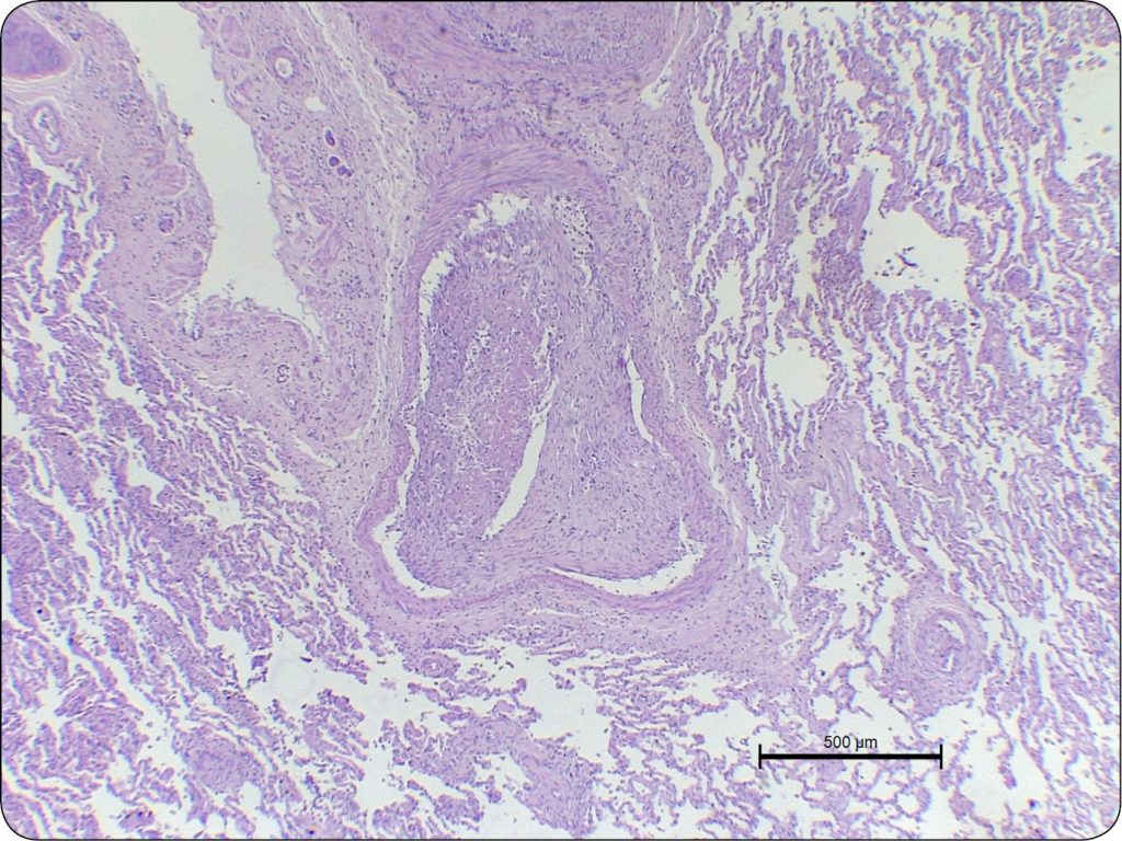 WWP_3_24_Izabela_Janus_ZMIANY_W_PRAWEJ_CZESCI_SERCA_RYC_7_A serca