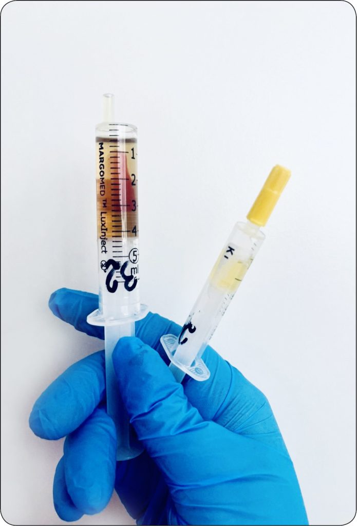 WWP_3_24_Lukasz_Adaszek_ZAKAZNE_ZAPALENIE_OTRZEWNEJ_U_KOTOW_RYC_4_A zapalenie otrzewnej