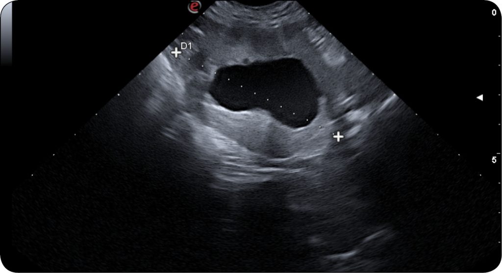 WWP_3_24_Agnieszka_Neska-Suszynska_LECZENIE_CHOROB_DOLNYCH_DROG_MOCZOWYCH_RYC_1