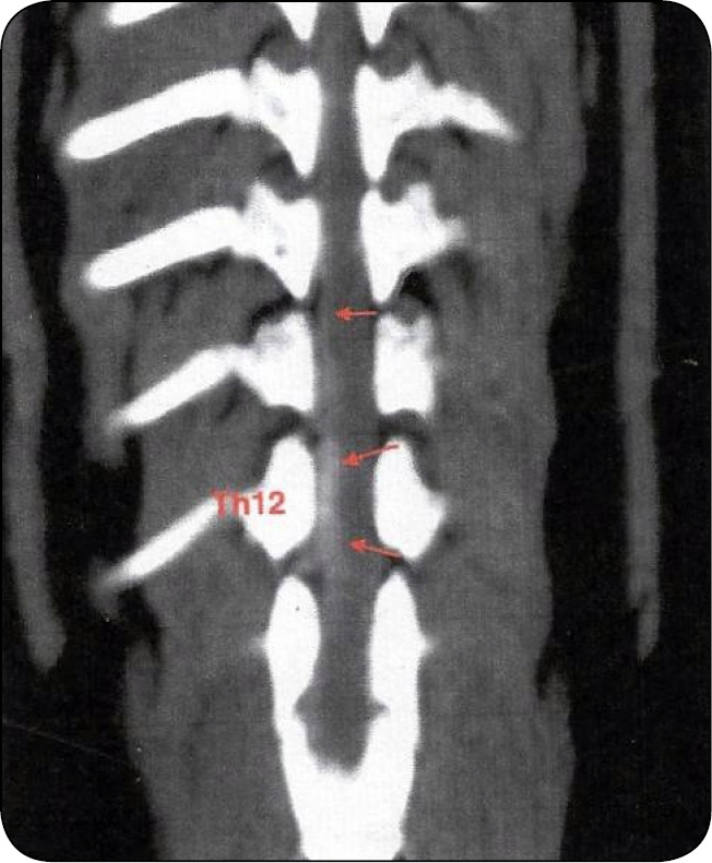 WWP_4_24_Magdalena_Plewa_NAUKA_CHODU_RDZENIOWEGO_RYC_4 nauka chodu