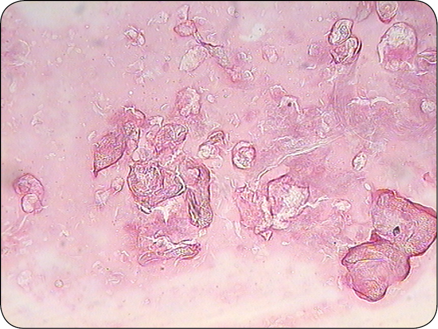 ENDO-DERMA_23_Maria_Katkiewicz_NOWOTWORY_MESZKOW_WLOSOWYCH_RYC_10