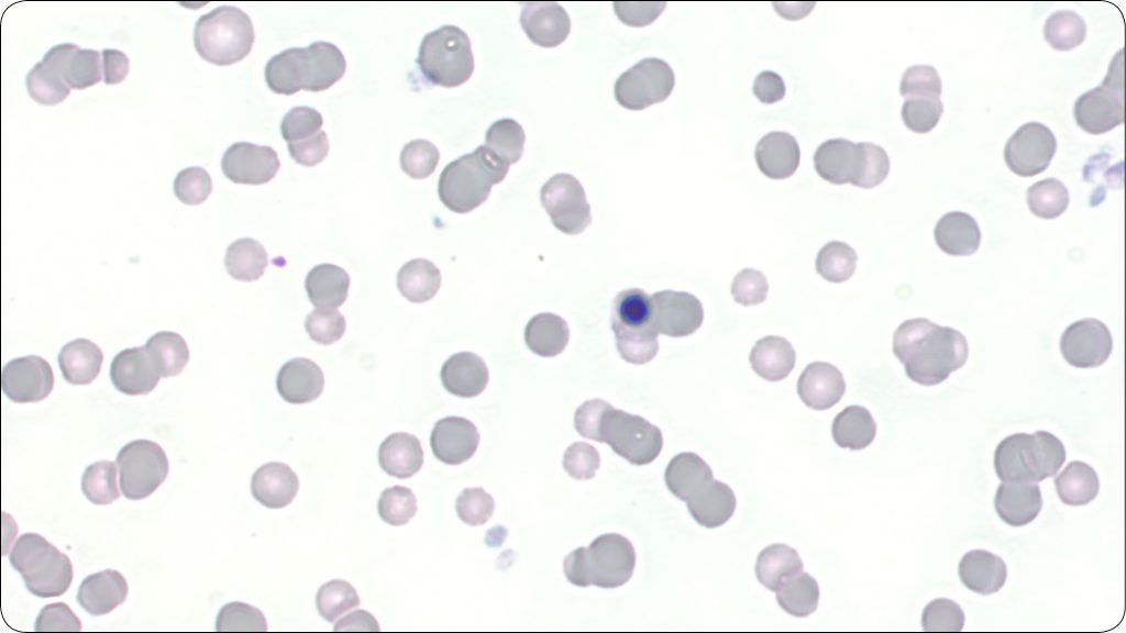 KONIE_24_Marzena_Paszkowska_KIEDY_WARTO_ZLECIC_ROZMAZ_KRWI_U_KONI_RYC_3