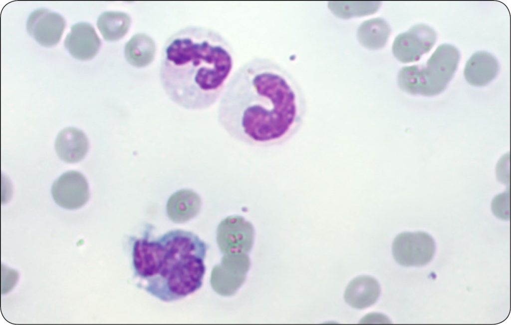 KONIE_24_Marzena_Paszkowska_KIEDY_WARTO_ZLECIC_ROZMAZ_KRWI_U_KONI_RYC_5