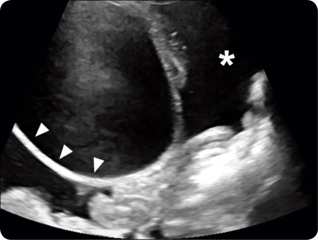 KONIE_24_Joanna_Bierla_UROPERITONEUM_U_ZREBIAT_RYC_1