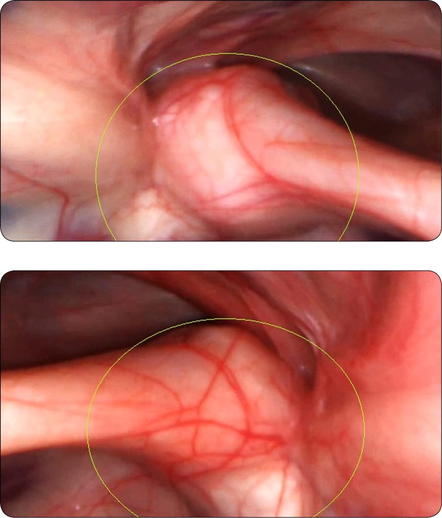 KONIE_24_Paulina_Zielinska_ARTROPATIA_SKRONIOWO-GNYKOWA_RYC_1