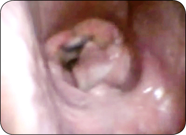 KONIE_24_Paulina_Zielinska_ARTROPATIA_SKRONIOWO-GNYKOWA_RYC_3