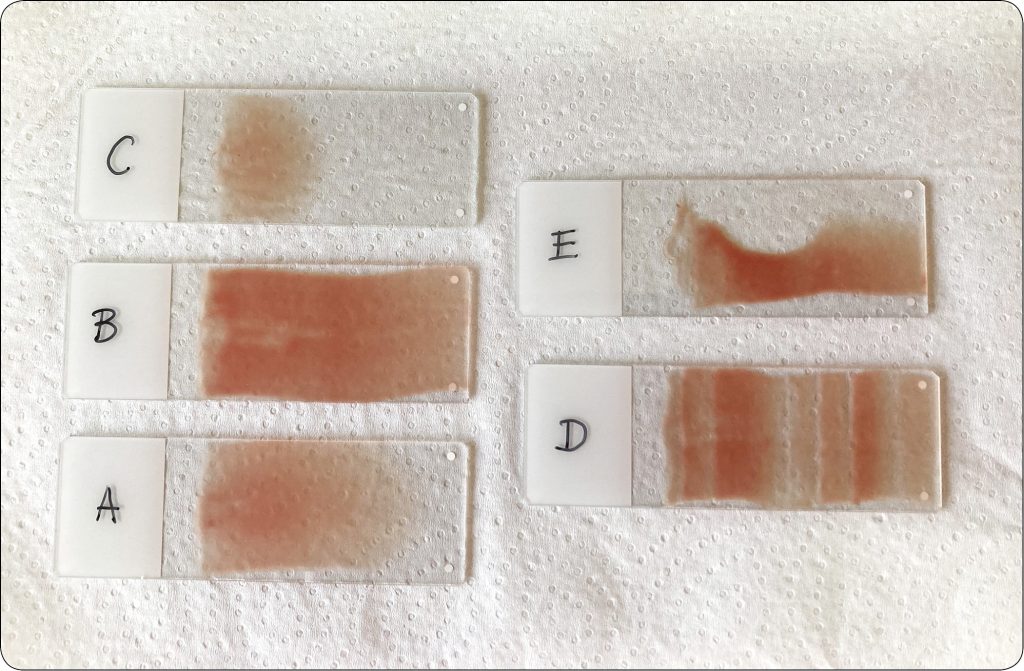 WWP_5_24_Ewa_Kumiega_AUTOMATYCZNA_ANALIZA_KRWI_OBWODOWEJ_A_ROZMAZ_MANUALNY_RYC_1 analiza krwi