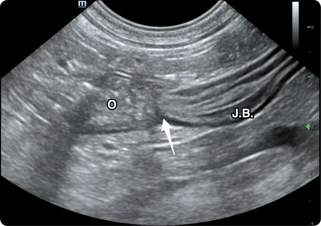 WWP_5_24_diagnostyka_Pawel_Brzostek_OCENA_OKREZNICY_W_BADANIU_USG_RYC_6