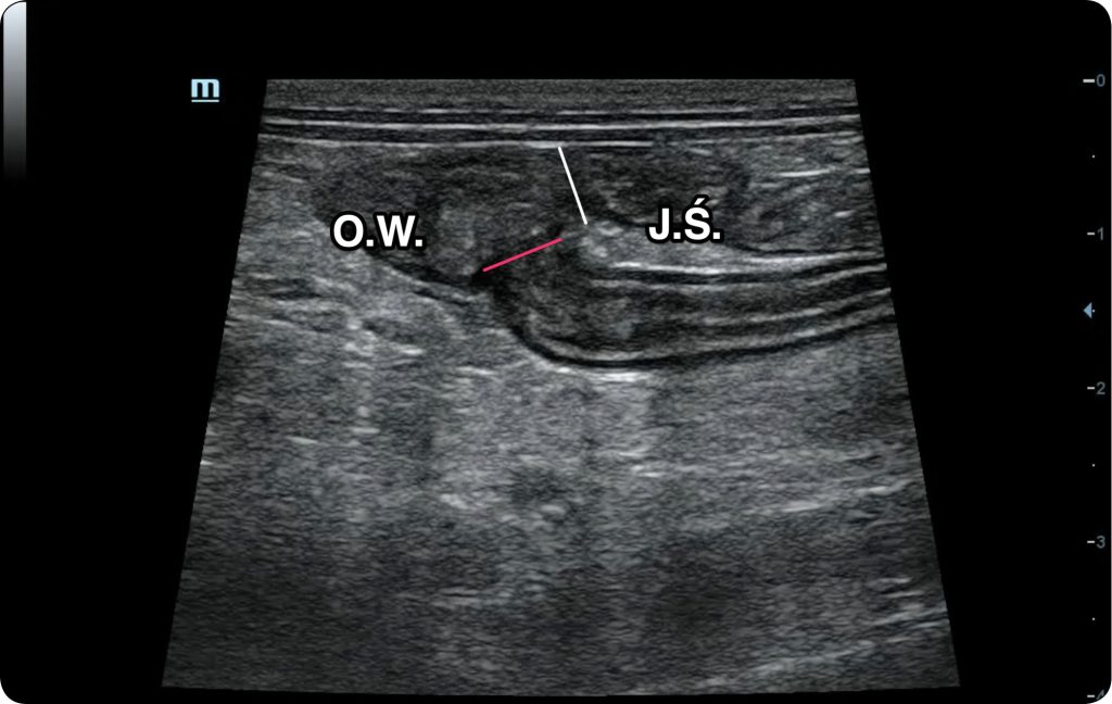 WWP_5_24_diagnostyka_Pawel_Brzostek_OCENA_OKREZNICY_W_BADANIU_USG_RYC_7