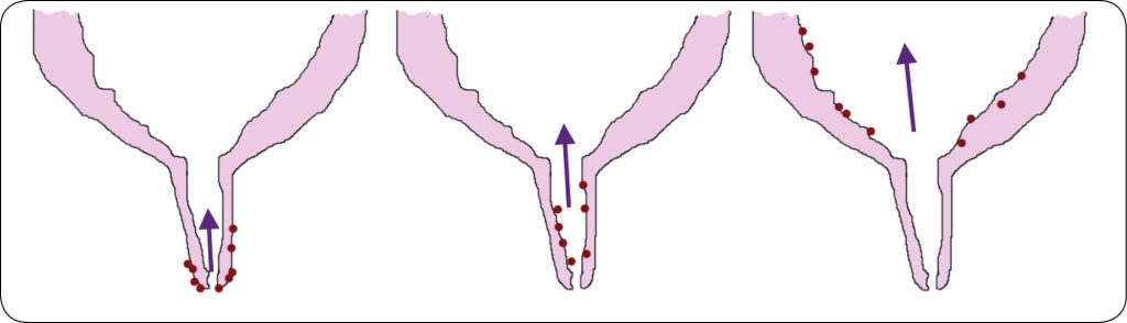 WWT_2_24_Aleksandra_Kalinska_ROZNE_OBLICZA_MASTITIS_U_KROW_MLECZNYCH_RYC_4