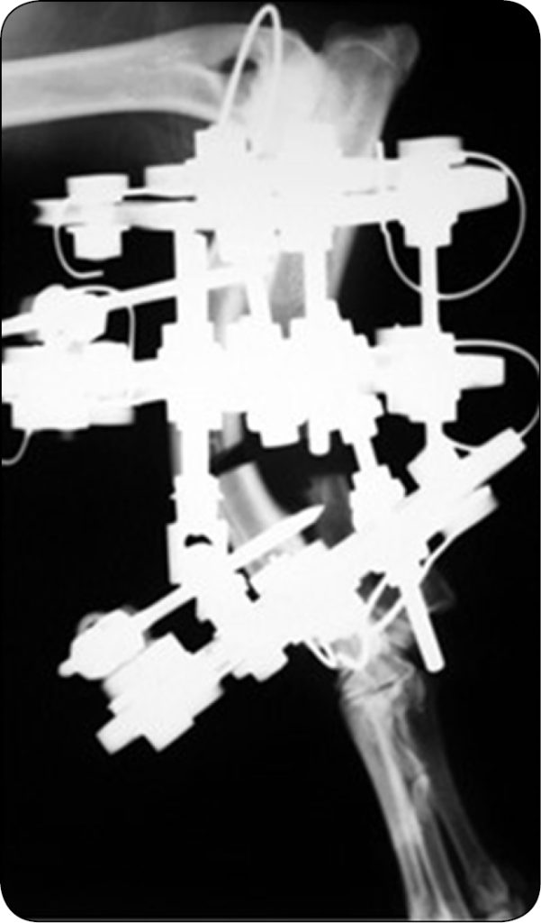 WWP_6_24_Gian_Luca_Rovesti_LECZENIE_DEFORMACJI_STABILIZTORY_KOLOWE_RYC_4_A