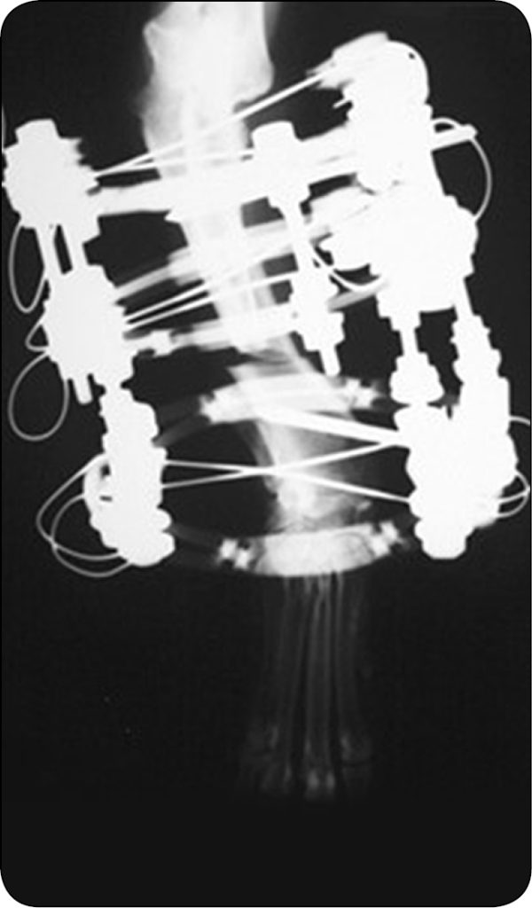 WWP_6_24_Gian_Luca_Rovesti_LECZENIE_DEFORMACJI_STABILIZTORY_KOLOWE_RYC_4_B