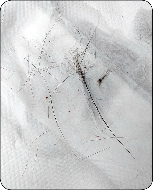 WWP_7-8_24_dermatologia_Paulina_Szczepaniak_SKORNY_ZESPOL_ATOPOWY_KOTOW_RYC_4 zespół atopowy