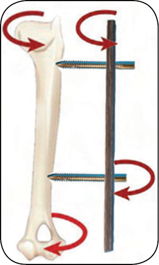 WWP_7-8_24_chirurgia_Gian_Luca_Rovesti_SYSTEM_ZEWNETRZNEJ_STABILIZCJI_LINIOWEJ_POLILOCK_RYC_10