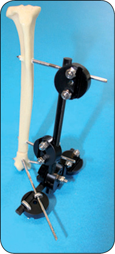 WWP_7-8_24_chirurgia_Gian_Luca_Rovesti_SYSTEM_ZEWNETRZNEJ_STABILIZCJI_LINIOWEJ_POLILOCK_RYC_16_A