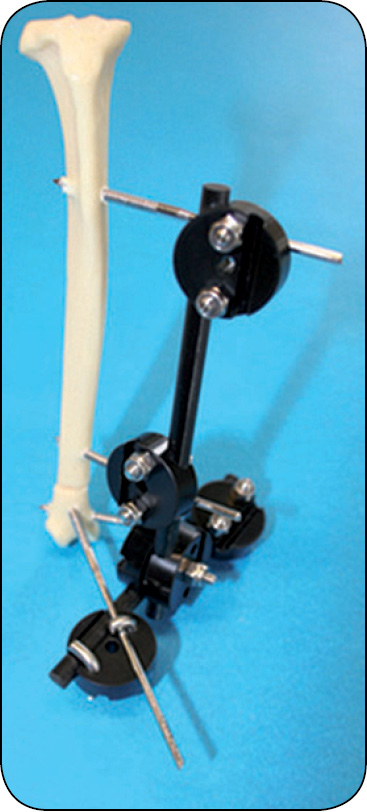 WWP_7-8_24_chirurgia_Gian_Luca_Rovesti_SYSTEM_ZEWNETRZNEJ_STABILIZCJI_LINIOWEJ_POLILOCK_RYC_16_D