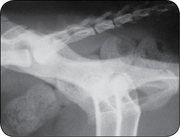 WWP_7-8_24_chirurgia_Gian_Luca_Rovesti_SYSTEM_ZEWNETRZNEJ_STABILIZCJI_LINIOWEJ_POLILOCK_RYC_20_A