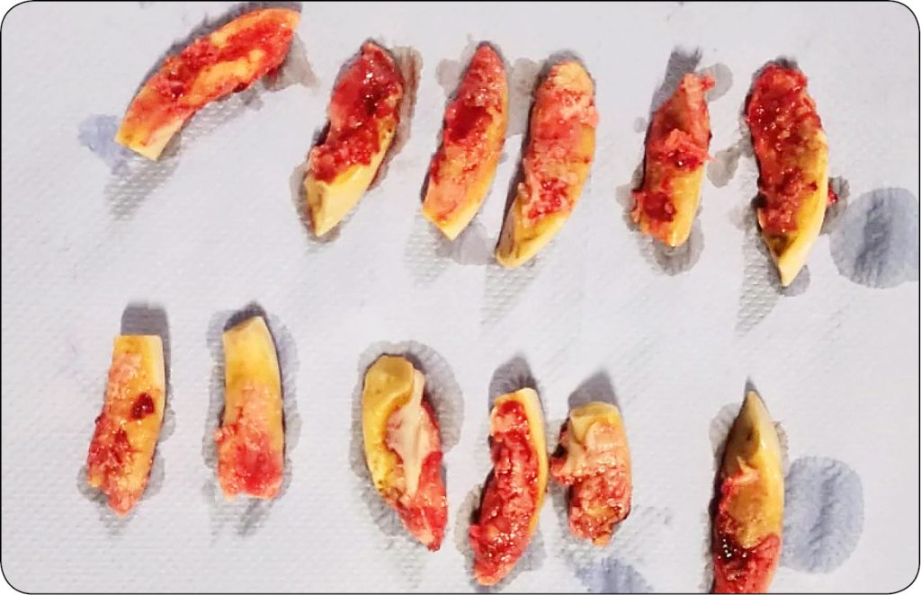 WWT_3_24_Katarzyna_Lagiewka_DIAGNOSTYKA_OBRAZOWA_W_PRZEBIEGU_EOTRH_RYC_14