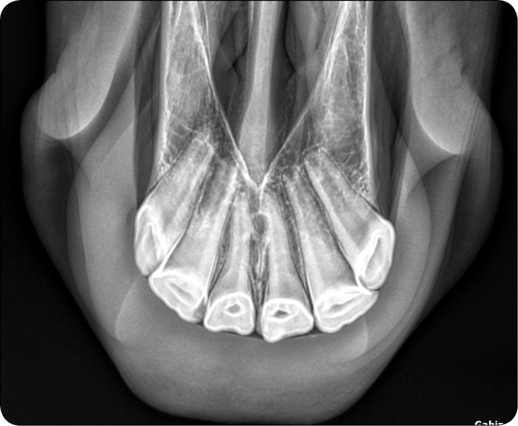 WWT_3_24_Katarzyna_Lagiewka_DIAGNOSTYKA_OBRAZOWA_W_PRZEBIEGU_EOTRH_RYC_6