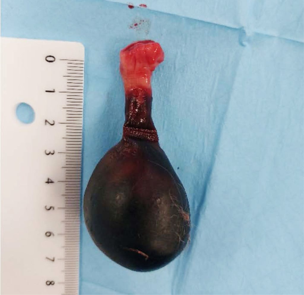 VET_CHIRURGIA_24_Dariusz_Jagodka_ROZNICIWANIE_GUZOW_I_WYPADNIECIA_POCHWY_RYC_7