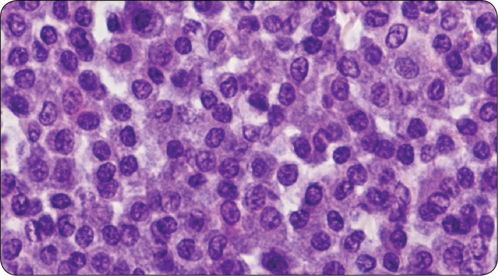 WWP_9_24_przewodnik_Heike_Aupperle-Lellbach_DIAGNOSTYKA_GUZOW_KOMOREK_TUCZNYCH_RYC_2