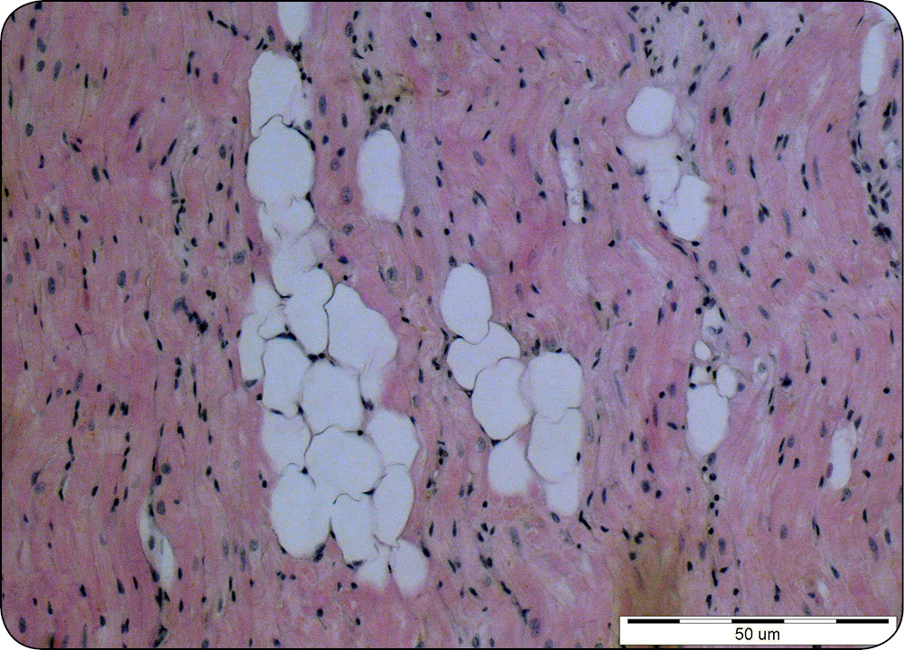 WWP_9_24_Urszula_Paslawska_WLOKNIENIE_W_CHOROBACH_SERCA_PSOW_I_KOTOW_RYC_1_A serca