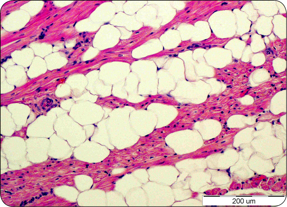 WWP_9_24_Urszula_Paslawska_WLOKNIENIE_W_CHOROBACH_SERCA_PSOW_I_KOTOW_RYC_1_B serca