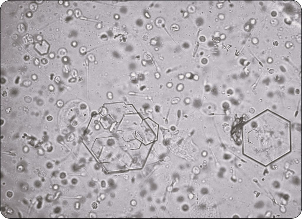 WWP_11-12_24_diagnostyka_laboratoryjna_Ewa_Kumiega_BADANIE_OSADU_MOCZU_RYC_2 moczu