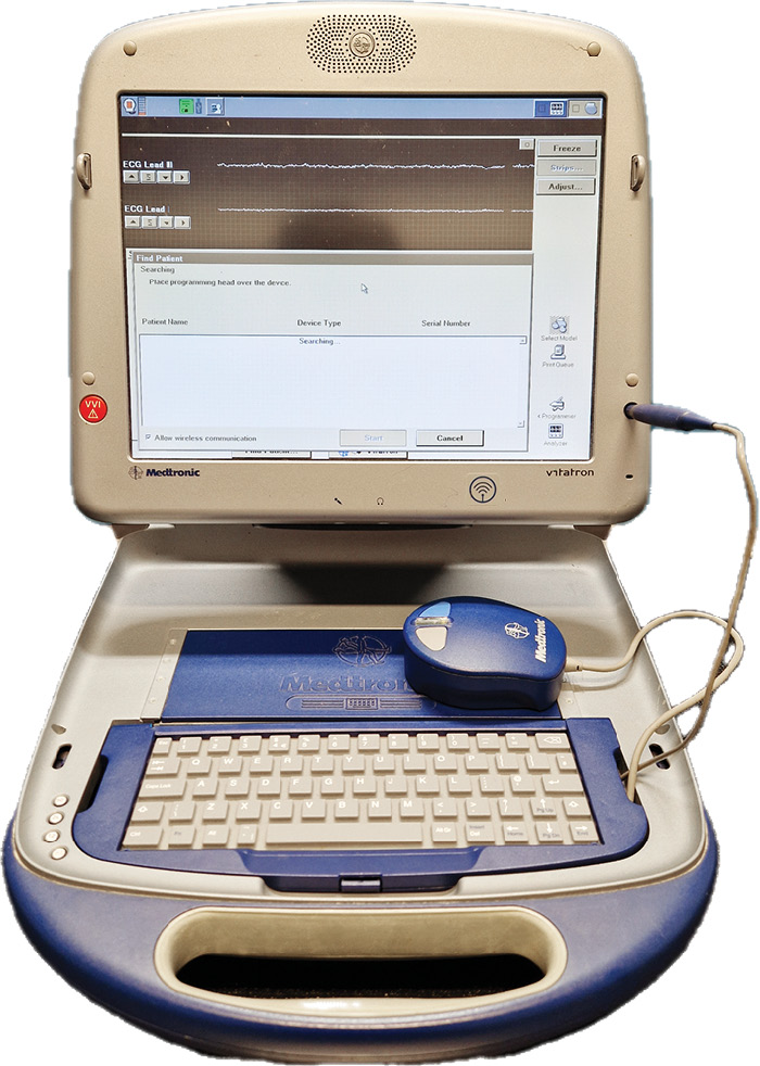 WWP_11-12_24_kardiologia_Maksymilian_Lewicki_PRAKTYCZNE_ASPEKTY_SZTUCZNEJ_STYMULACJI_SERCA_RYC_3