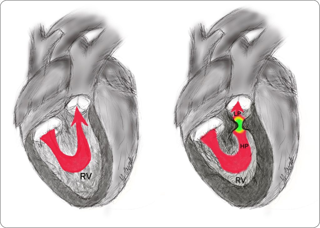 KARDIO_24_Magdalena_Grzech-Wojciechowska_WADY_WRODZONE_SERCA_PRAWEGO_U_PSOW_I_KOTOW_RYC_1