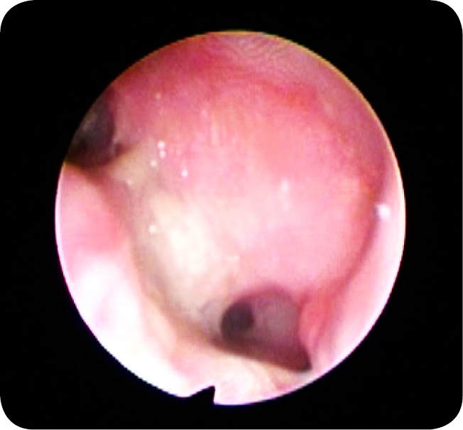 MEDYCYNA_KOTOW_24_Marcin_Jankowski_IDIOPATYCZNE_ZAPALENIE_NOSA_U_KOTOW_RYC_5