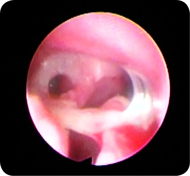 MEDYCYNA_KOTOW_24_Marcin_Jankowski_IDIOPATYCZNE_ZAPALENIE_NOSA_U_KOTOW_RYC_6