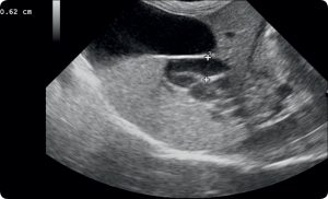 WWP_3_16_UCHYLKI_PRZELYKU_U_PSOW_I_KOTOW_RYC_1