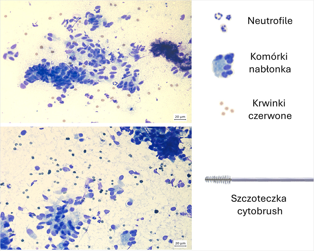 ROZROD_KONI_25_Lukasz_Zdrojkowski_BADANIE_CYTOLOGICZNE_W_ROZRODZIE_KONI_RYC_1