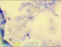 Dermatozy
