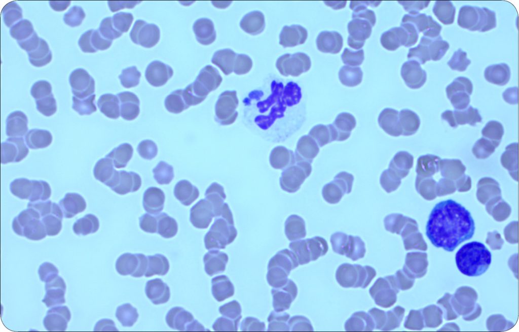 CHOROBY_KONI_25_Marzena_Paszkowska_CHOROBY_ODKLESZCZOWE_DIAGNOSTYKA_RYC_4