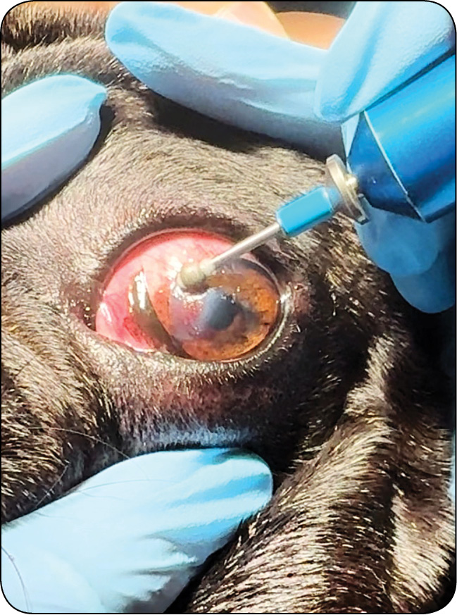 WWP_4_25_okulistyka_Katarzyna_Szulc_OWRZODZENIA_ROGOWKI_KLASYFIKACJA_DIAGNOSTYKA_LECZENIE_RYC_17 rogówki