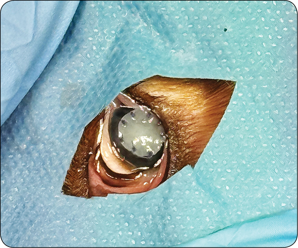 WWP_4_25_okulistyka_Katarzyna_Szulc_OWRZODZENIA_ROGOWKI_KLASYFIKACJA_DIAGNOSTYKA_LECZENIE_RYC_18 rogówki