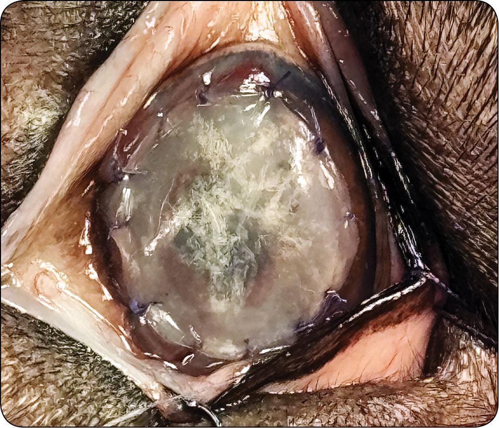 WWP_4_25_okulistyka_Katarzyna_Szulc_OWRZODZENIA_ROGOWKI_KLASYFIKACJA_DIAGNOSTYKA_LECZENIE_RYC_120 rogówki