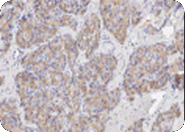 ENDO-DERMA_25_Krystyna_Pierzchala-Koziec_RZADKIE_ENDOKRYNOPATIE_U_PSOW_I_KOTOW_RYC_4 endokrynopatie