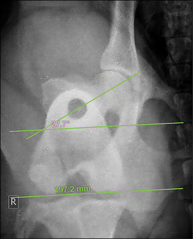 VET_CHIRURGIA_25_Magdalena_Rembowska_LECZENIE_OPERACYJNE_ZWICHNIECIA_PRZYSRODKOWEGO_RZEPKI_RYC_6 Osteotomia
