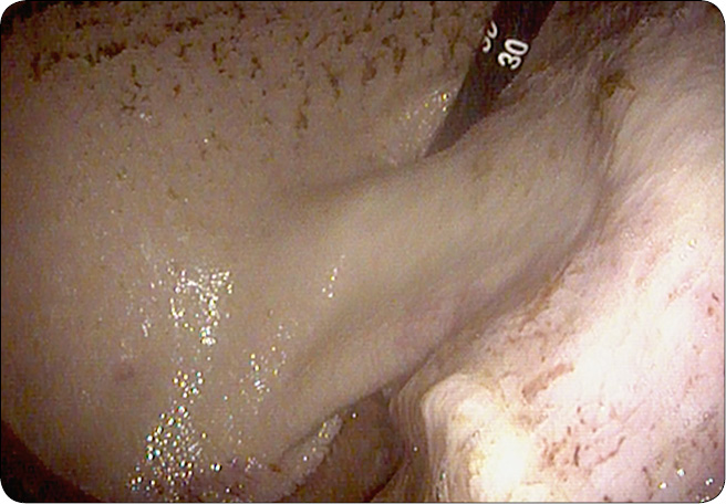 WWT_3_25_Anna_Biazik_konie_CHOROBA_WRZODOWA_ZOLADKA_RYC_3