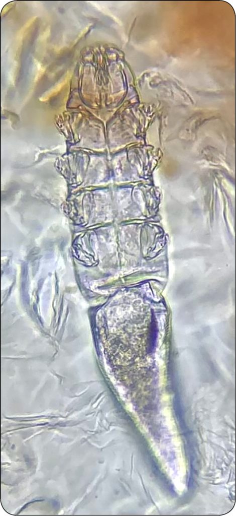 WWP_10_25_dermatologia_Monika_Pozniak_NUZYCA_WIEKU_DOROSLEGO_RYC_1_A